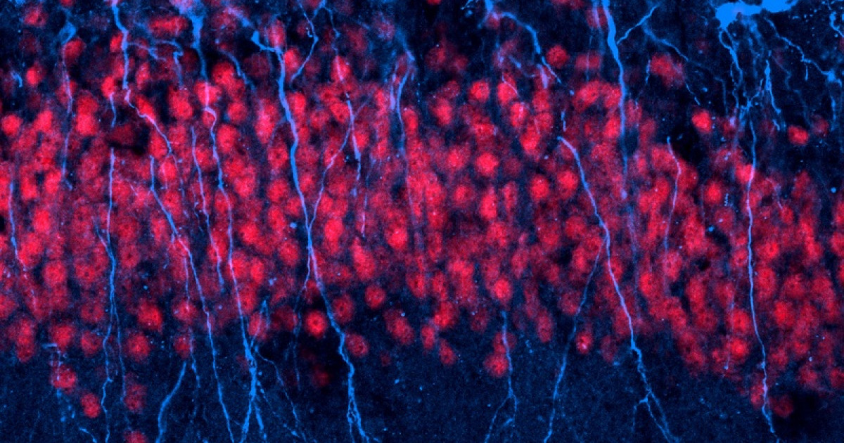 Resultado de imagen de neurogénesis